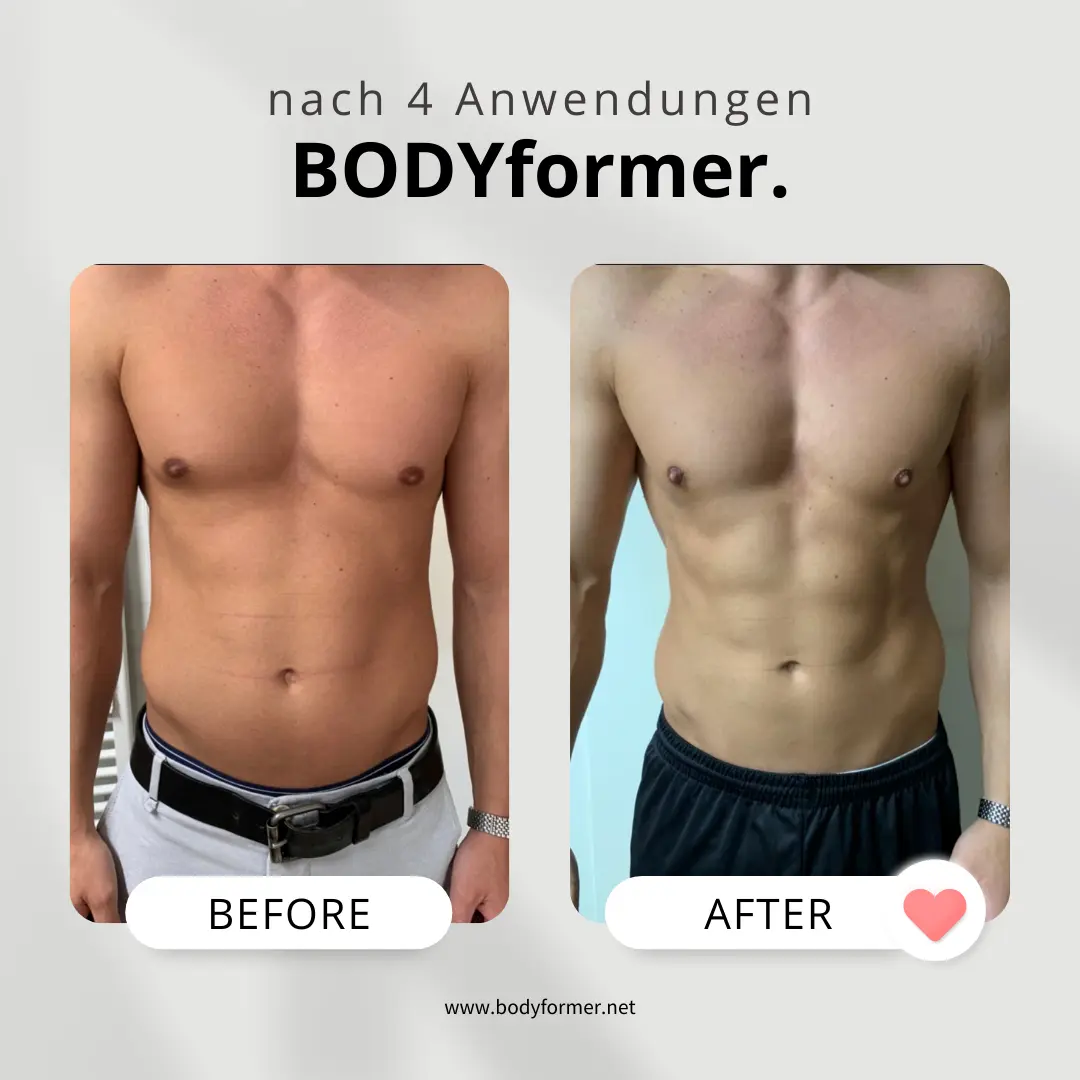 BODYformer vorher-nachher