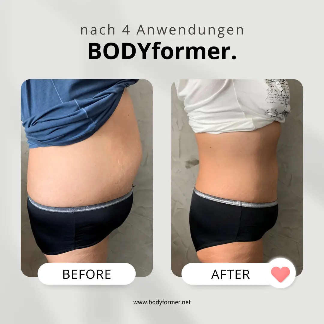 BODYformer vorher-nachher